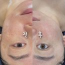 봉곡동395 | 구미 피부관리샵 어디갈까? 하이푸리프팅 &amp; 고주파리프팅 후기 – 봉곡동 부티난다