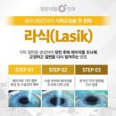우안과의원 | 은평구 만족스러운 라식 수술 안과 후기