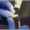 신기한의원 | 치석제거 하면서 느꼈던 신기한 변화들 솔직 후기!