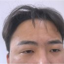 예쁜눈썹