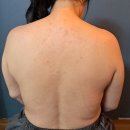 구암동646 | [ 버섯목 증후군 관리 후기 ] 등 수기 관리 전문 북구 구암동 단아스킨케어