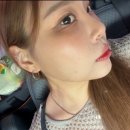 압구정 성형외과 티타늄 리프팅 후기 즉각적 효과 원한다면 추천
