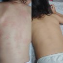 아이워시 이미지
