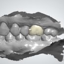 더바른치과기공소 이미지