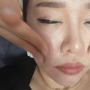 CU 라온더샵점 | 대구 진천동 피부샵 Goodface 굿페이스 기미잡티토닝으로 기미 박멸