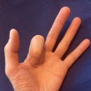 수지힘찬한의원 이미지