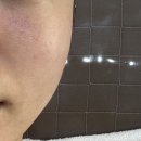 성미 | 일산 정발산 맞춤 피부관리 후기｜성미스킨케어