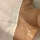 평촌피부관리 리컴뷰티에서 하이푸리프팅 후기