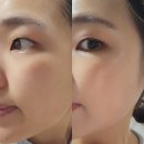 대박슈퍼 | 레디우스 리뉴 슈퍼 볼륨 세럼 | 탄력세럼 추천 후기
