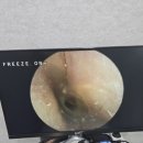 금강보청기 송파센터 | 송파보청기 맞춤 상담은 금강보청기 송파잠실센터에서 받았어요