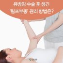 유방암 수술 후 생긴 ‘림프부종’ 관리 방법은? ﻿ 이미지