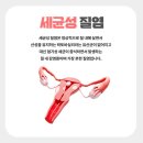 주영여성의원 | 조심해야되고 질 면역력 높여야돼요 (feat. 칸디다질염 세균성질염) [울산 주영여성의원 달동 산부인과]