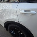 에스덴트 | 잠실외형복원 10년 노하우로 찌그러짐 감쪽같이 펴준 에스디테일 후기