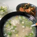 디폴트커피라이트 | [13년만에 개안한 썰] 스마일프로 내돈내산 신사역 ㅇㅅㅇㅇ안과 수술후기(시력1.2) 관리꿀팁첨부