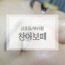 금호동 뷰러펌 / 브라질리언 왁싱 / '찬아보떼' 완전 만족스러운 후기