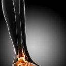 죽전정형외과의원 이미지