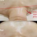 연에스테틱 네이버블로그