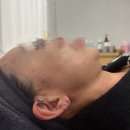 태봉로(태봉초교 ~ 송우고교앞) | 포천피부관리 다이어트 업센다 이중턱 쉼 에스테틱 관리후기