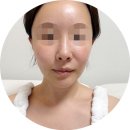 머드독 | 주사피부염 피부장벽 관리 후기, 오돌토돌 구진, 열감 진정 루틴