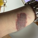 강남-002 | 문신제거 002) 문신 지우는 영수쌤 병원, 강남역 2회차 후기 내돈내산!