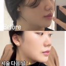 디에스타의원 | 소개팅 전날, 급하게 예뻐지고 싶을 때 천호 디에스타의원