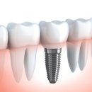 웰리브홀딩스 이미지