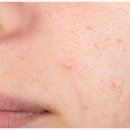 빌라드스킨피부과의원 이미지