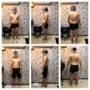 포프로짐 이미지