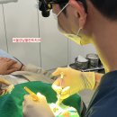 아름다운미소치과의원 | 천안 직산 치과, 앞니 이 사이 벌어짐 '다이아스테마' 레진 전 후 치료 후기