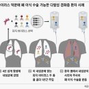 ① 전 인류의 목숨을 위협하는 충격적인 항생제 내성균 "슈퍼버그(Superbug)" 이미지