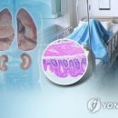 ■ 공기에 2일간 노출된 주사 맞은 환자 패혈증 사망 이미지