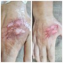 라라코리아 | 라라코리아 제품 사용 후기 | 라라소닉, 라라셀파 등 찐후기