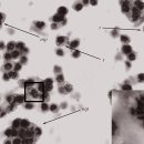 킹크랩 (Paralithodes sp.)의 Hematodinium 감염 bitter crab syndrome (BCS) 이미지