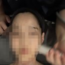 아이오마클리닉 | 선릉 피지관리 :: 맞춤형 스킨케어 해주는 아이오마클리닉 솔직 후기