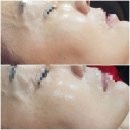 뷰티센 네이버블로그