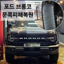 지금은덴트시대