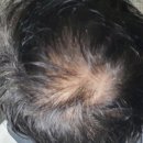 이종수내과의원 | [공지] 3쾌4무(藥) 비누/얼굴깨끗.피부.두피염증.탈모.비듬 가려움증.상처치료까지.