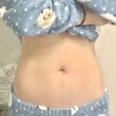 디디동물병원 | 두쫀쿠로 최고몸무게 찍다 유라인클리닉 지방분해주사 복부컷주사 6회차 후기 (비포&amp;애프터)