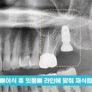 나치과 이미지