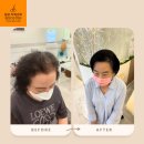 은평-010 | 은평 두피문신 후기｜구파발·연신내 정수리 탈모 자연스럽게 채우는 방법