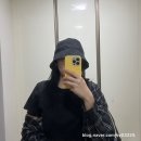 (주)메디코어 | (미용코)화살코, 코 수술 후기(수술 당일~2주간의 자세한 통증, 병원 방문 등)