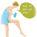 부딪치지도 않았는데 멍이 든다면... 이미지