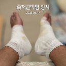 지간신경종 다 나았습니다ㅠㅠㅊ 이미지