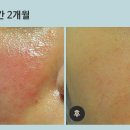한맘한의원 네이버블로그