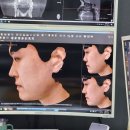 프레쉬이비인후과의원 | 양재역 프레쉬이비인후과에서 비염수술 &amp; 미용코 상담받은 후기 (1)