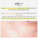 실비가 | 한관종 제거 비용 후기,실비 청구 전 꼭 확인하세요