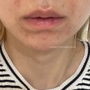 구주약국 | 비타민B 부족 증상 &amp; 고함량 비타민B 컴플렉스 영양제 내돈내산 후기