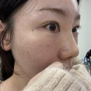 상봉비브톤의원 네이버블로그
