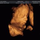 태양메디 이미지