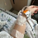 남5통(신기) | 모든게 일주일만에 일어난 일이라면 믿어지나요 (급성담낭염(담석증) 수술후기 / 쓸개 제거 복강경 후기)